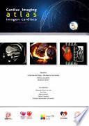 Libro Atlas de Imagen Cardíaca-Cardiac Imaging Atlas