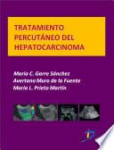 Libro Tratamiento percutáneo del hepatocarcinoma